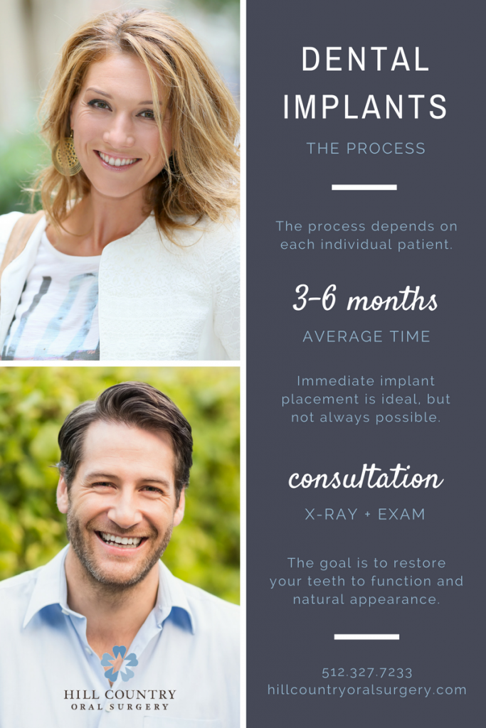 Dental Implant Process Infographic Dental Implant Process Infographic